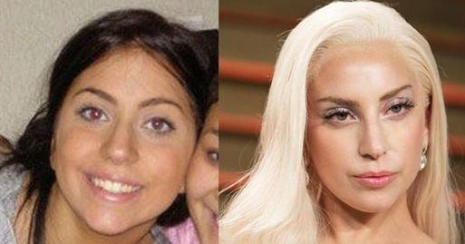 Lady Gaga’nın muhteşem değişimi