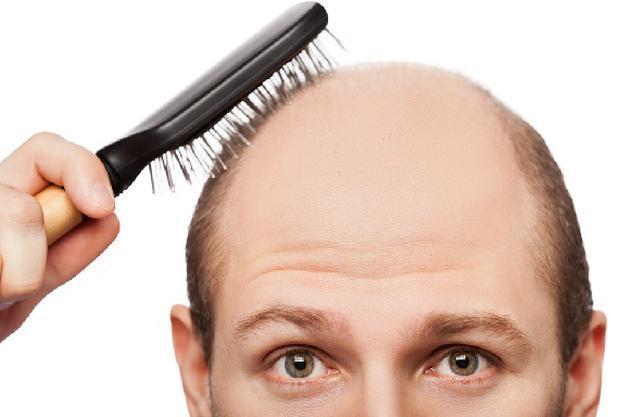 Otolog Micro Greft, saçınızı baştan çıkarır…