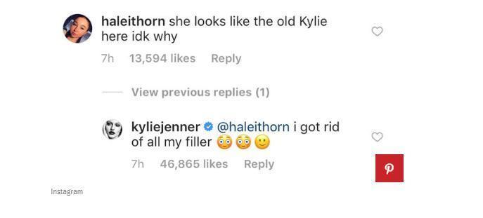 Kylie Jenner dudak dolgusunu çıkardığını açıkladı