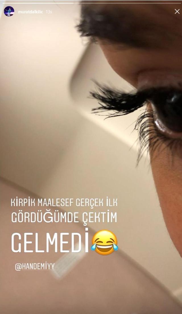 Murat Dalkılıç, sevgilisi Hande Erçelin kirpiklerini paylaştı, sosyal medya yıkıldı