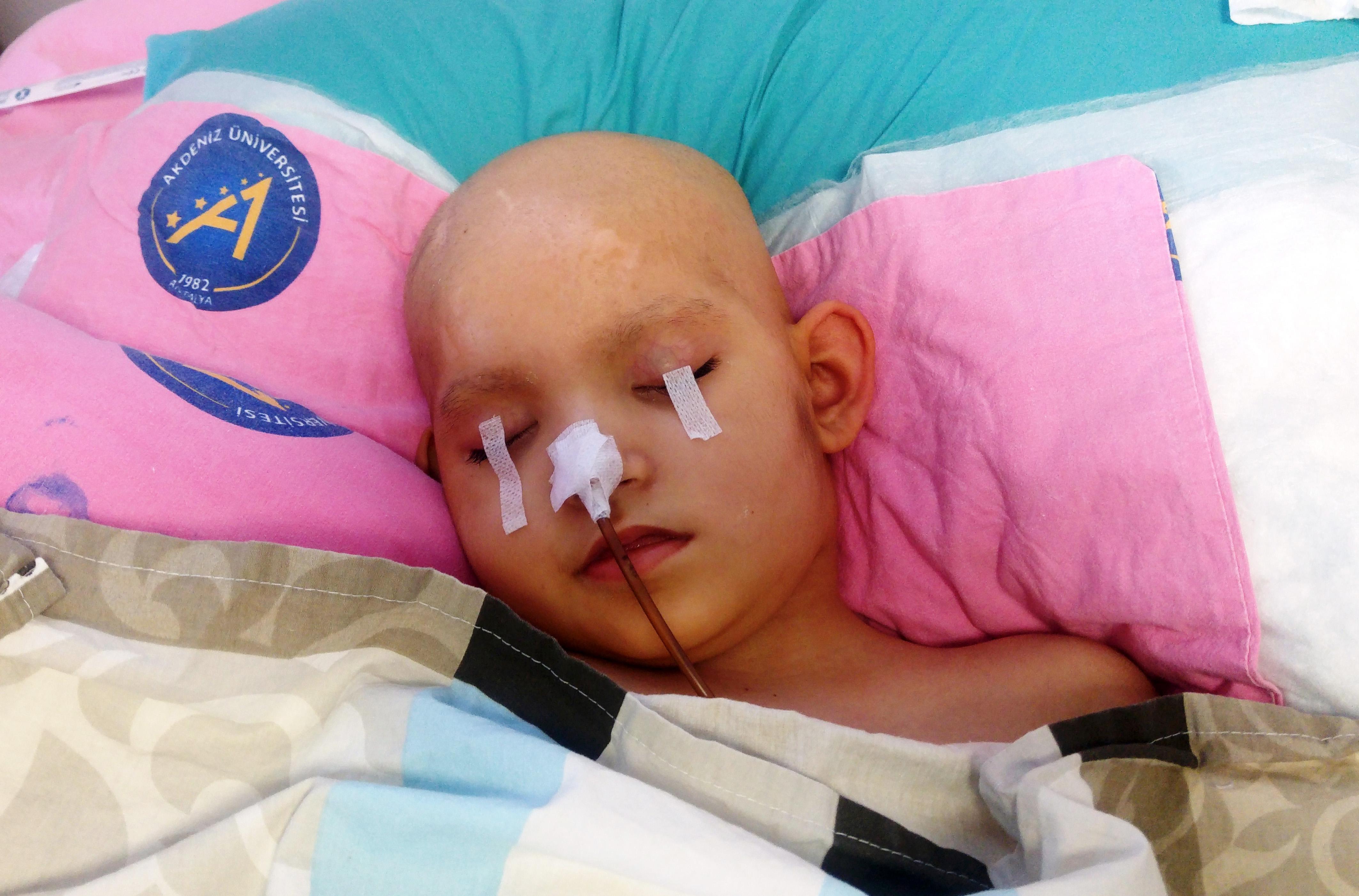 Beyin sapı tümörü patlayan 6 yaşındaki Rümeysa yaşam savaşı veriyor
