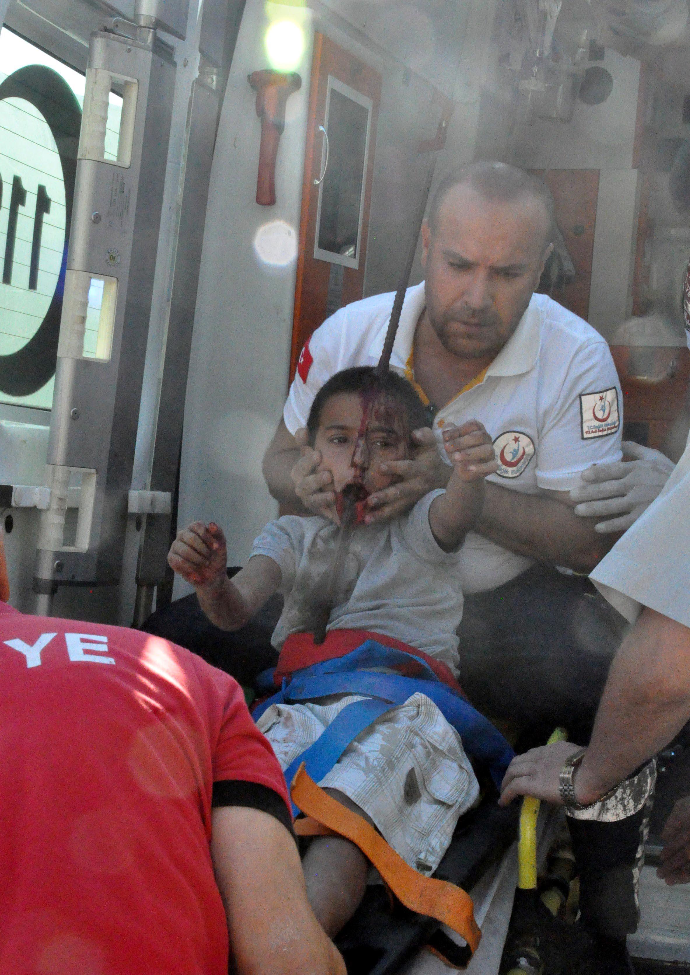 Zonguldakta düşen çocuğun başına demir çubuk saplandı
