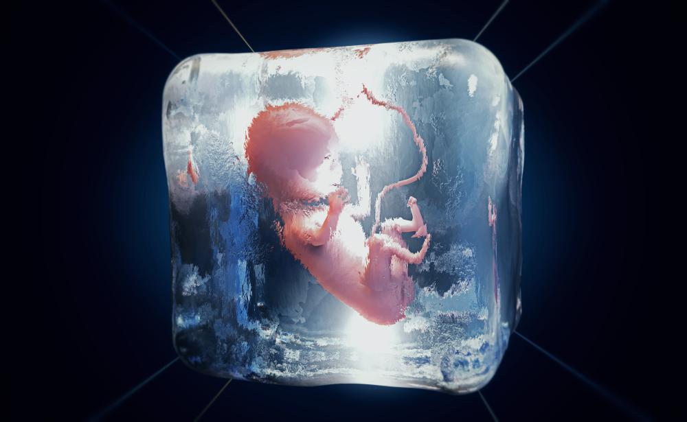 Dondurulmuş embriyo transferi nedir, nasıl yapılır