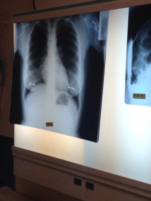 Kızının röntgenini görünce çıldırdı