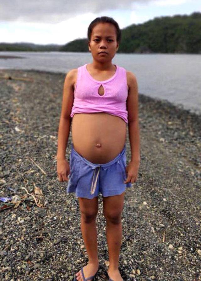 17 yaşındaki kız balıktan hamile kaldı