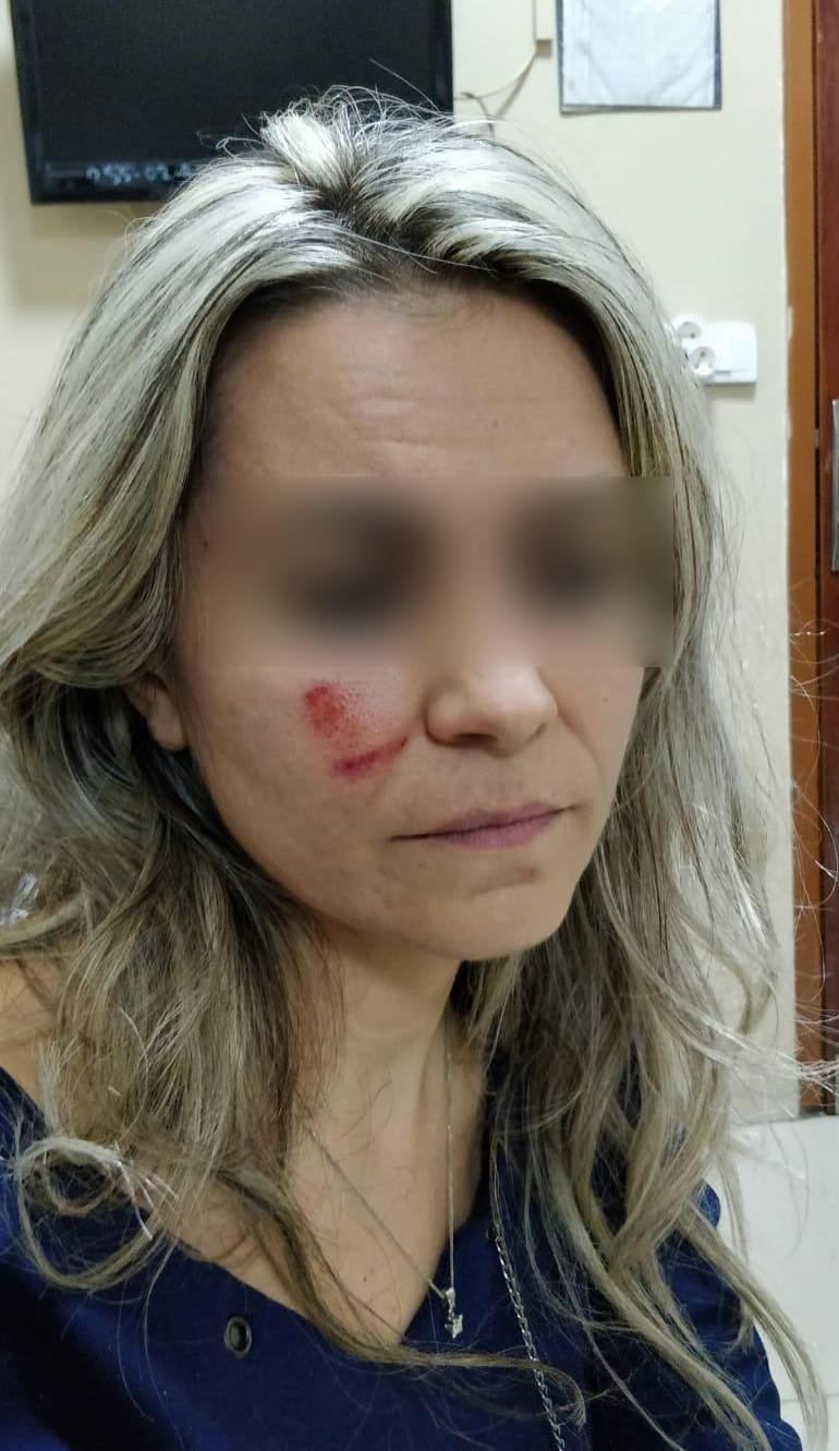 Hastane çıkışı kadın doktora saldırı