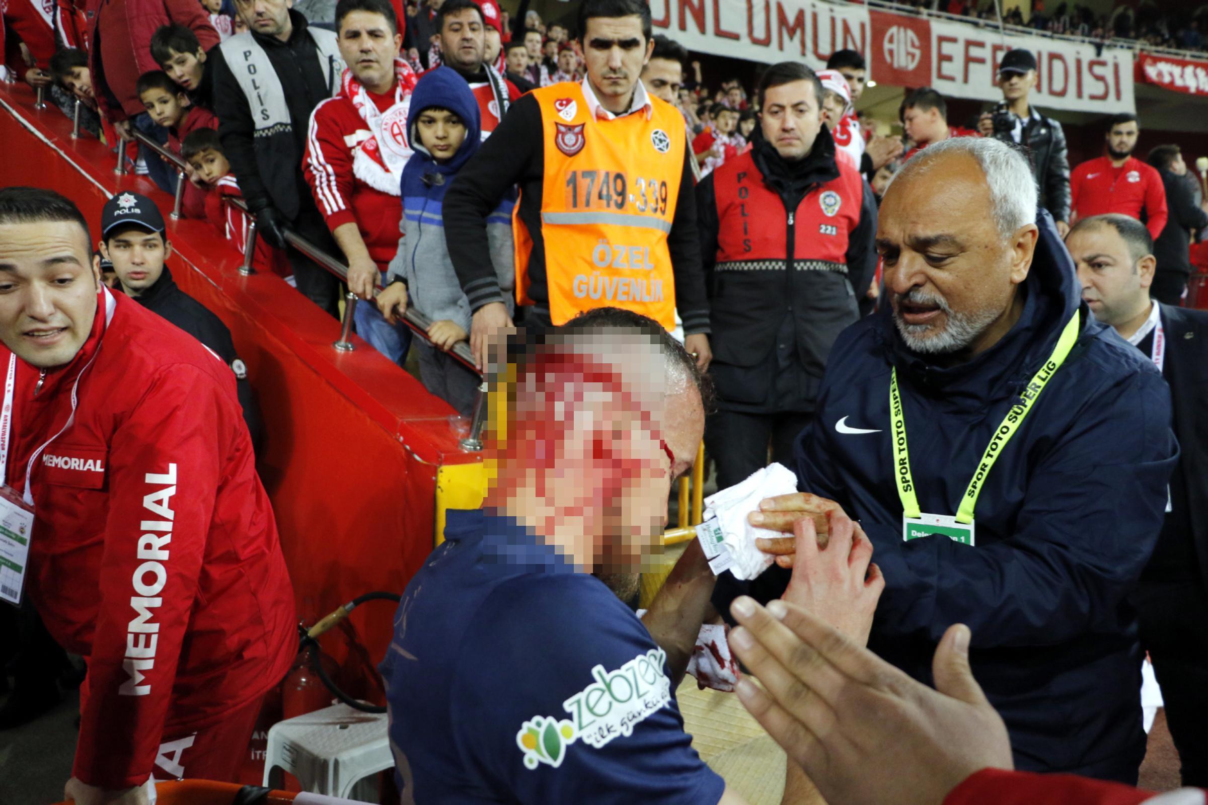 Antalyasporda talihsiz anlar: Chiconun burnu kırıldı