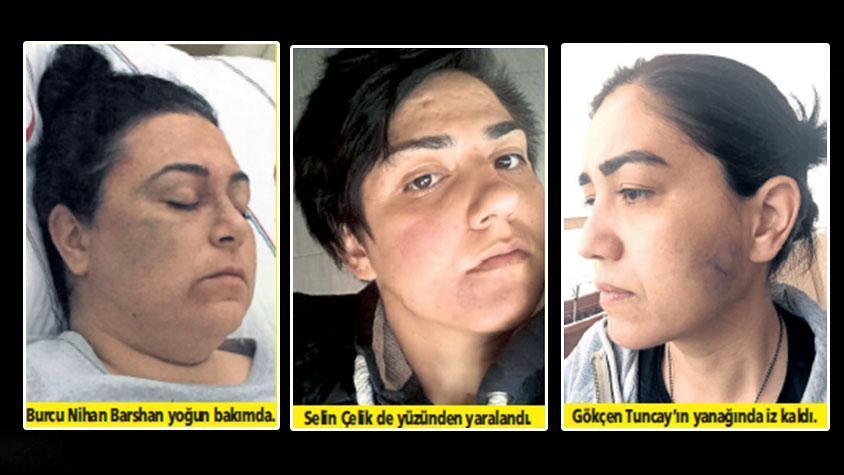 Antalya’da sokak ortasında 3 kadına saldıran zanlı serbest