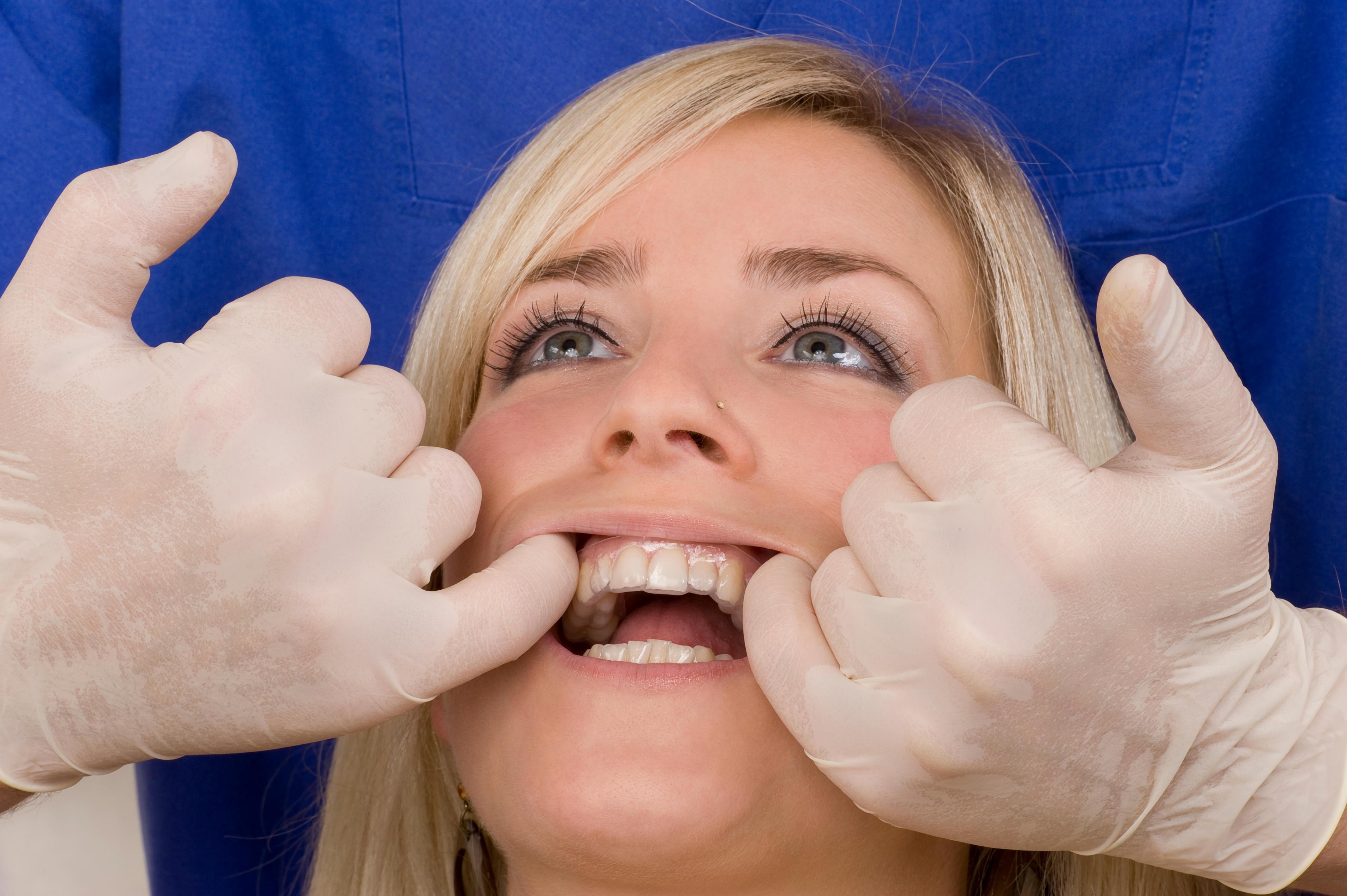 Eksik dişlerin yerine ne yapılabilir Tamamlamak için 6 ayınız var