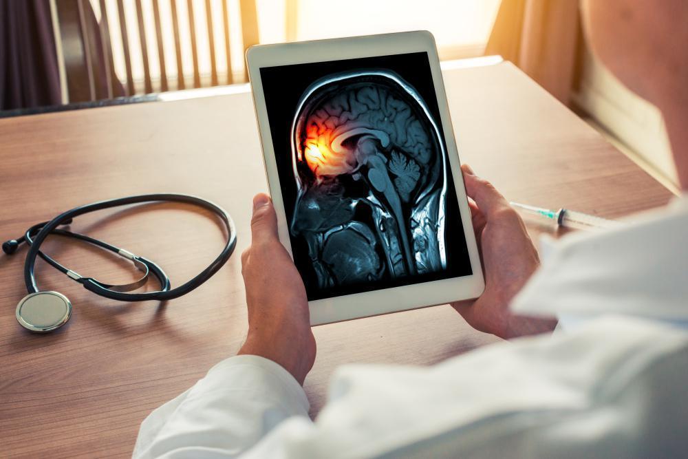 Amerikan Baş Ağrısı Birliği açıkladı: Migren cerrahisi sınıfı geçemedi