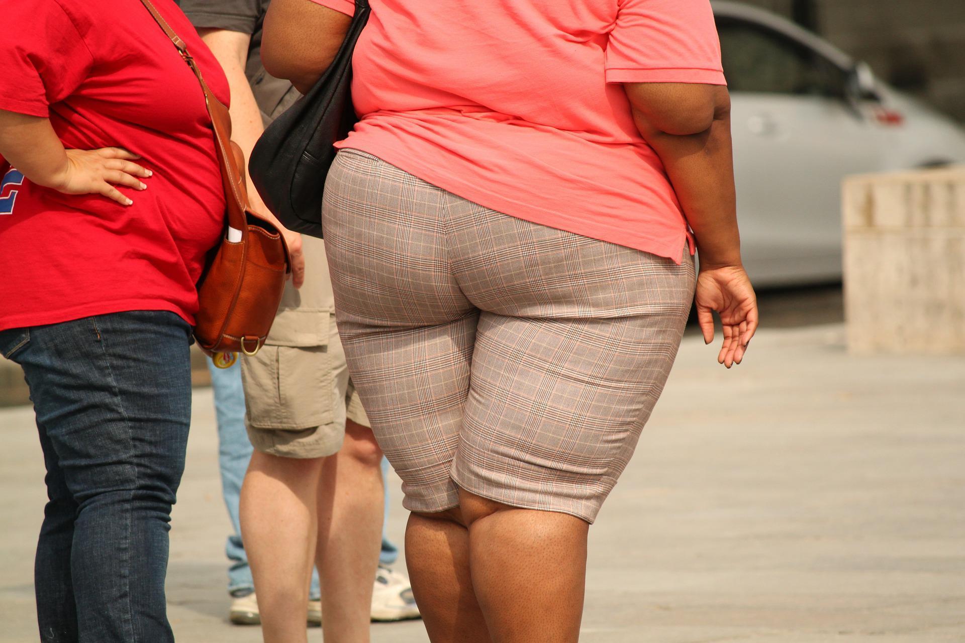 Polikistik over sendromlu kadınların %60’ı obez