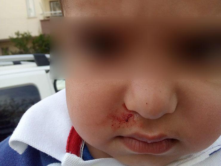 Kreşte 3 yaşındaki çocuğa darp iddiası