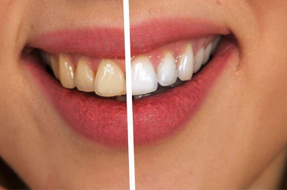 Diş etleriniz ile eklemlerinizin sağlığı birbirine bağlı