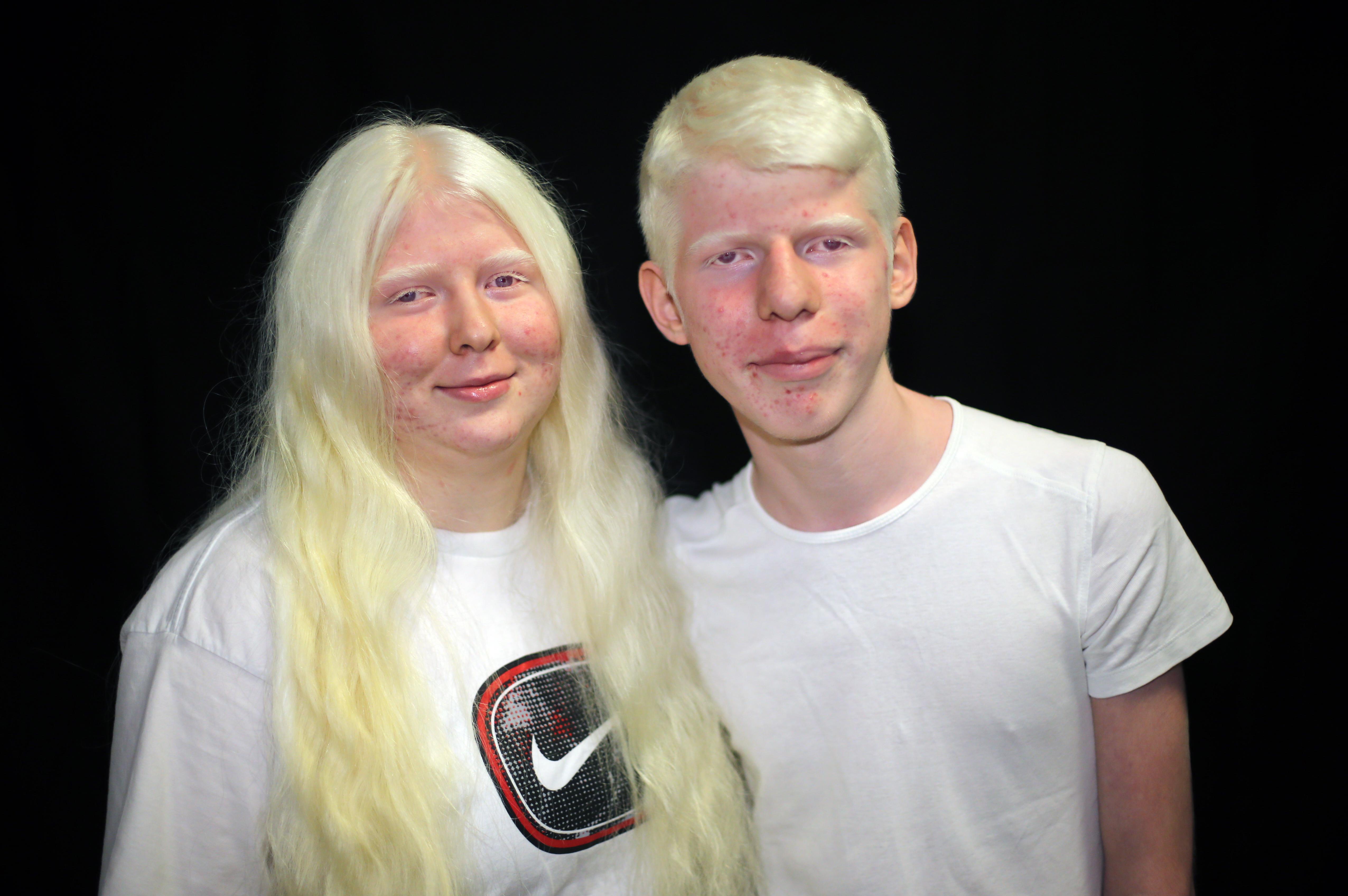 Çukurovanın sıcağında albino olmak