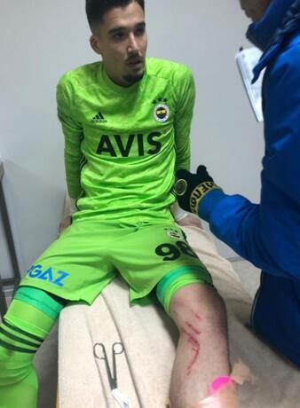 Fenerbahçe Yeni Malatyaspor deplasmanından yaralı döndü