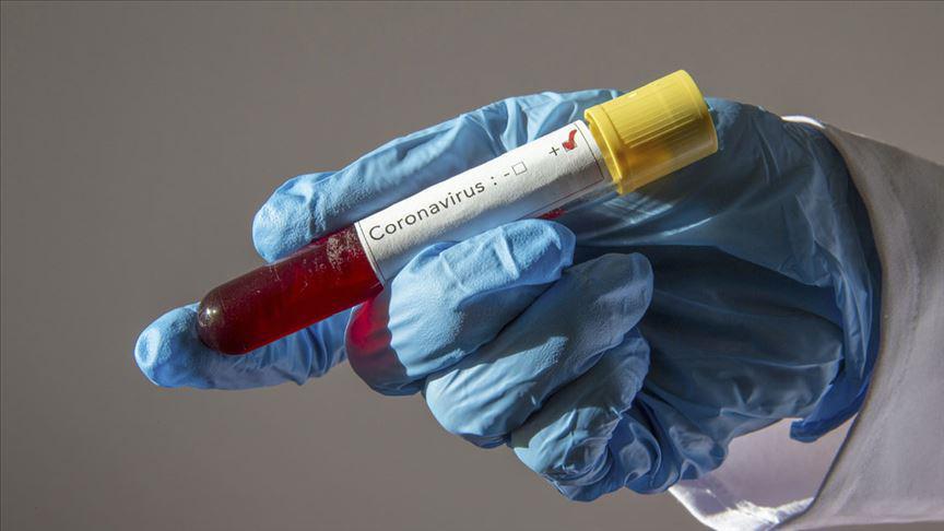 İtalyada koronavirüs nedeniyle hayatını kaybedenlerin sayısı 463e yükseldi
