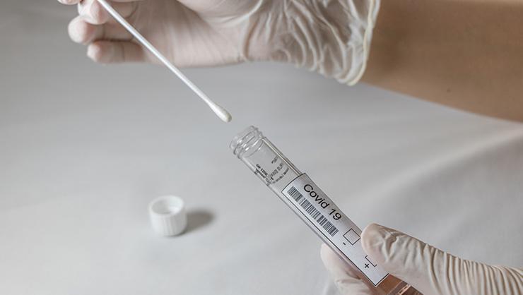 PCR testi özel hastanelerde yapılıyor mu PCR testi ücretli mi, nerede yapılır