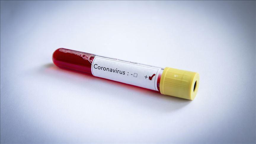 Corona virüs aşısında müjde Ankaradan geldi
