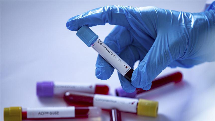 Sağlık Bakanlığı Referans Laboratuvarında corona virüsü izole edildi
