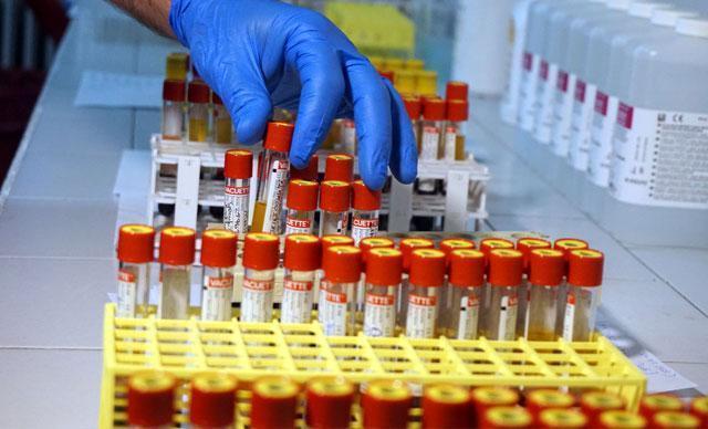 Sağlık Bakanlığından corona virüs test ücretleri için açıklama