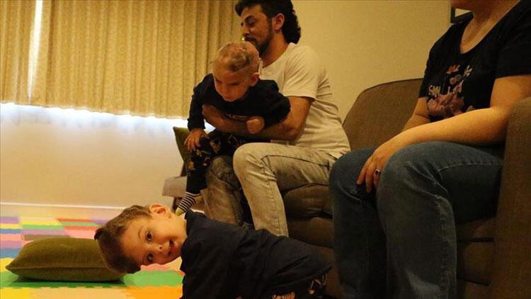 Erdoğan operasyonla ayrılan siyam ikizlerinin ailesiyle görüştü