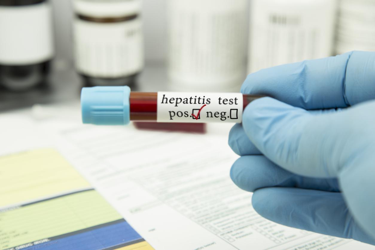 Viral hepatitler yılda 1 milyondan fazla can alıyor