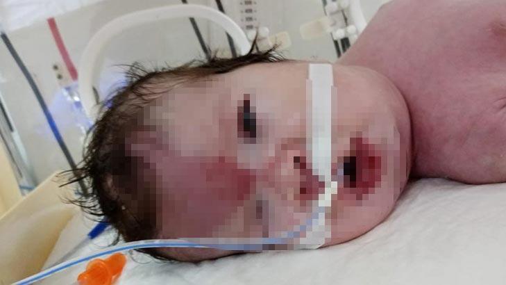 Doğum raporunda erkek olan bebek kız çıktı, aile hastaneden şikayetçi oldu