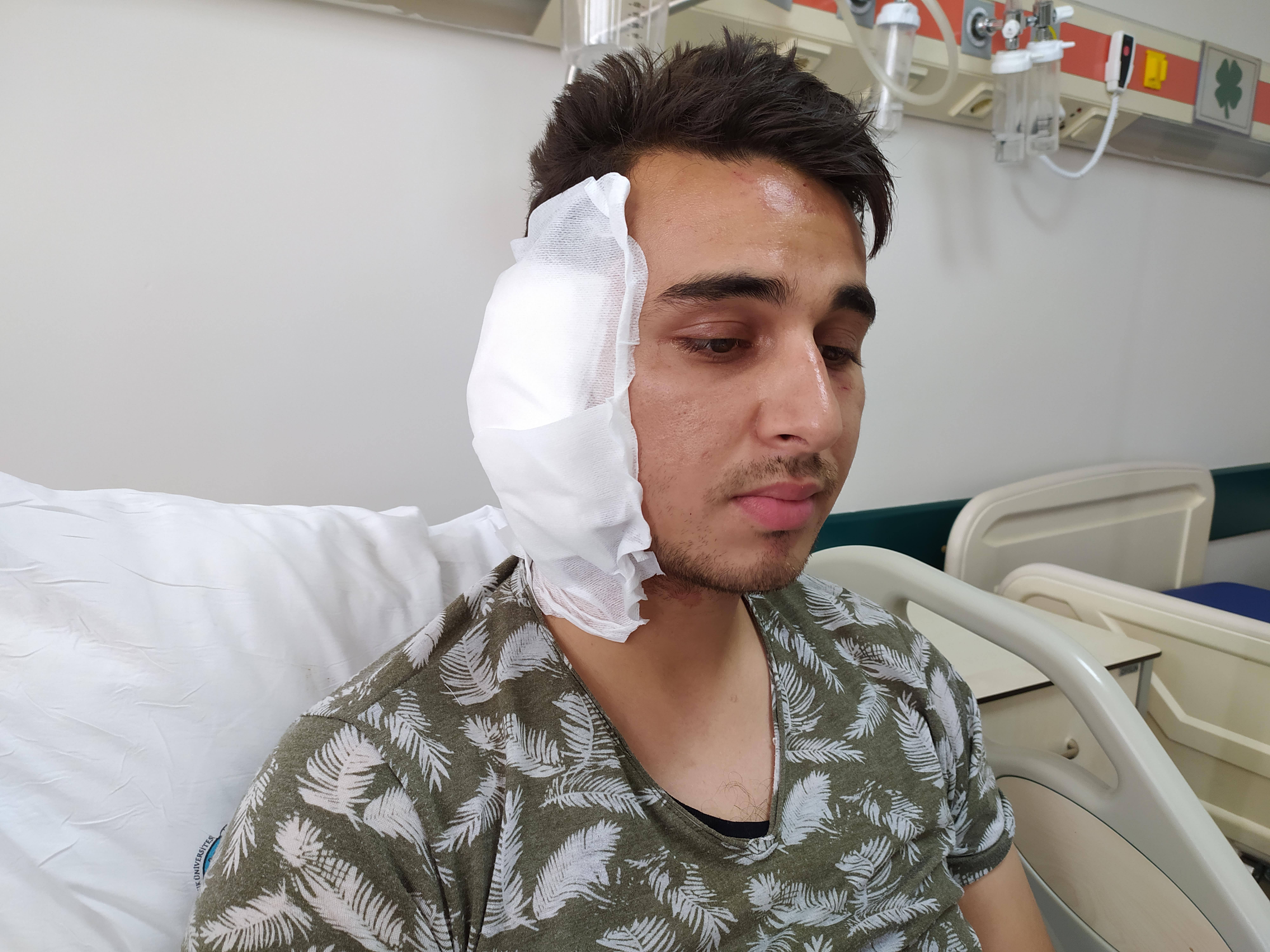 Postacının kavga sırasında kulağını ısırarak koparan saldırgan tutuklandı