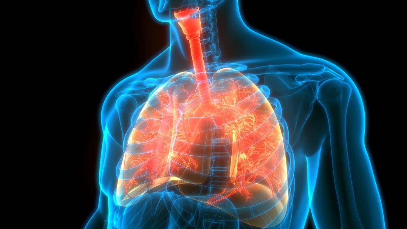 Akciğer sönmesi (pnömotoraks) nedir Akciğer sönmesi neden olur, belirtileri nelerdir
