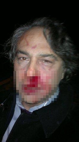 Barbaros Şansal KKTC’den sınır dışı edildi, Türkiyede uçaktan inerken saldırıya uğradı