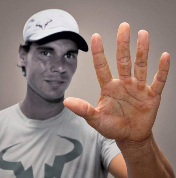 Roger Federer ve Rafael Nadalın nasırlı elleri...