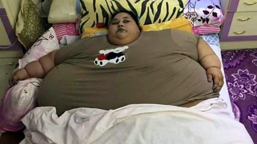 Dünyanın en kilolu kadını ameliyatla 100 kilo zayıfladı
