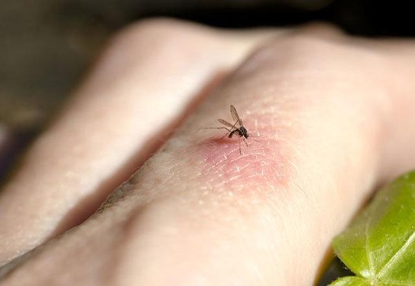 Dikkat Sivrisinek ısırığı hasta edebilir