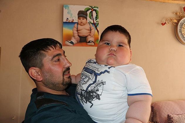 Doyma hissi bulunmayan 1,5 yaşındaki Yağız 32 kiloya ulaştı