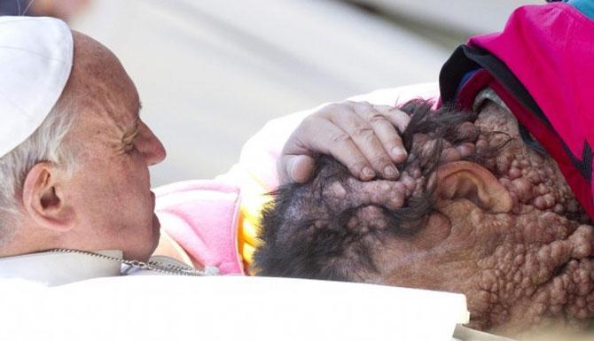 Papa bu kez de yüzü olmayan adama sarıldı