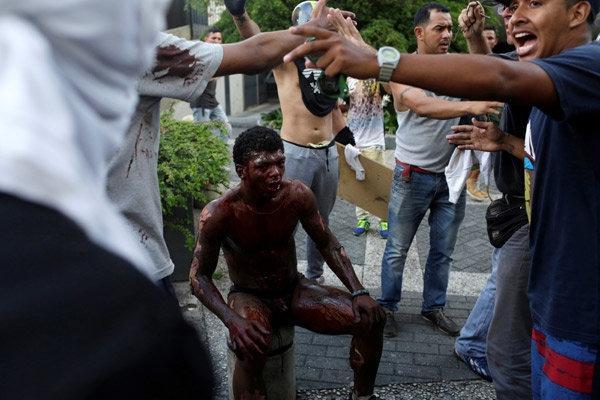 Venezuelada bir gösterici diri diri yandı