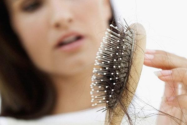 Saç dökülmesinin 6 ayrı türü var (Saç ekimi hakkında her şey)