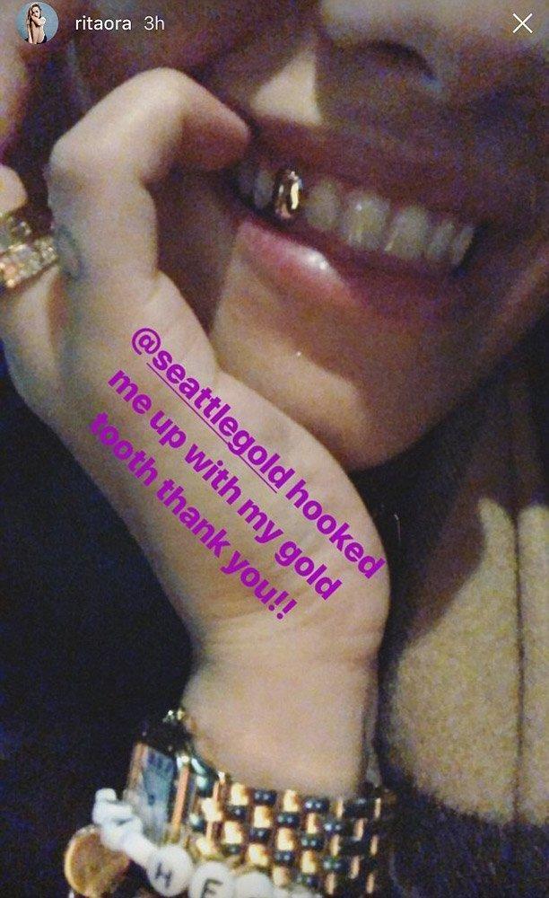Kendall Jenner’dan sonra Rita Ora da altın diş yaptırdı