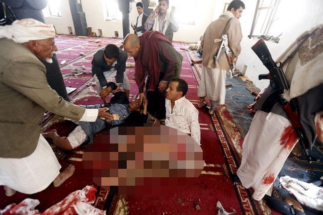 Yemende IŞİD camileri vurdu: 137 ölü, 345 yaralı