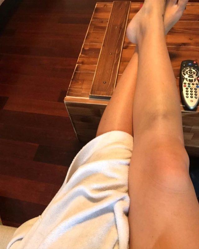 Seda Akgülden kendisini eleştiren takipçisine bacak fotoğrafıyla yanıt