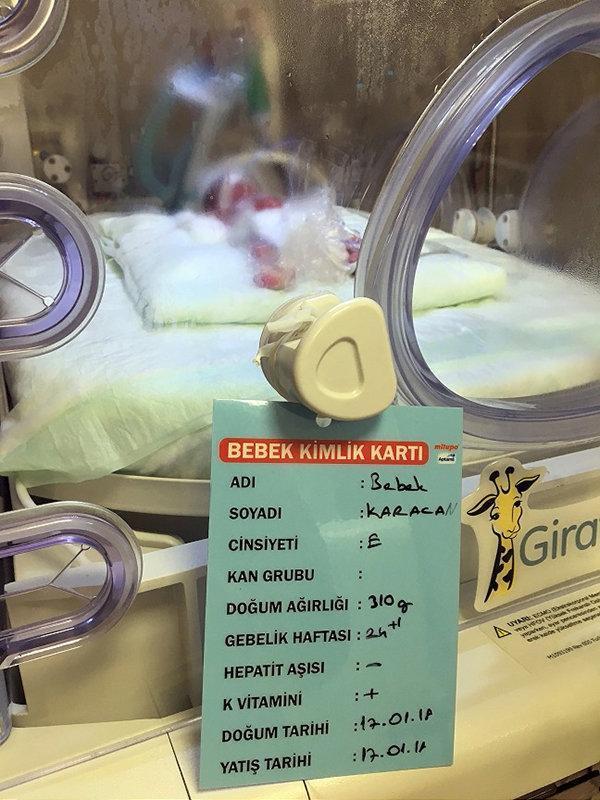 Tuğra bebek 310 gram dünyaya geldi