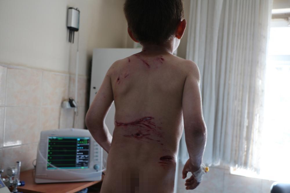 Şemdinlide 5 yaşındaki Eyüp köpeklerin saldırısına uğradı