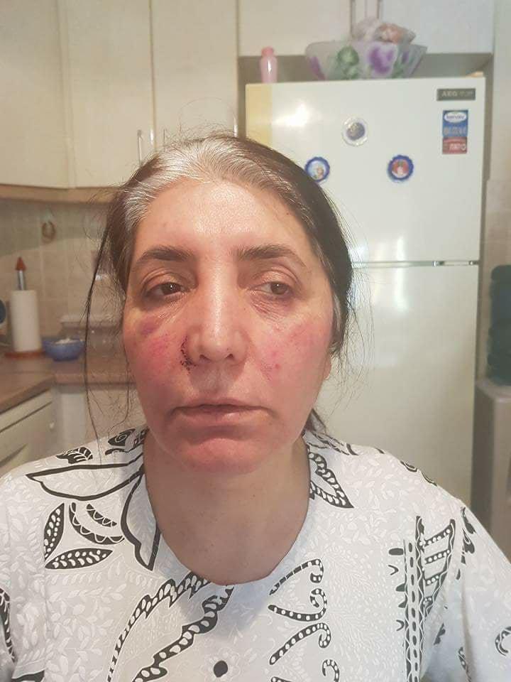 Bursada 2 kadın 2 erkek tarafından sokak ortasında dövüldü