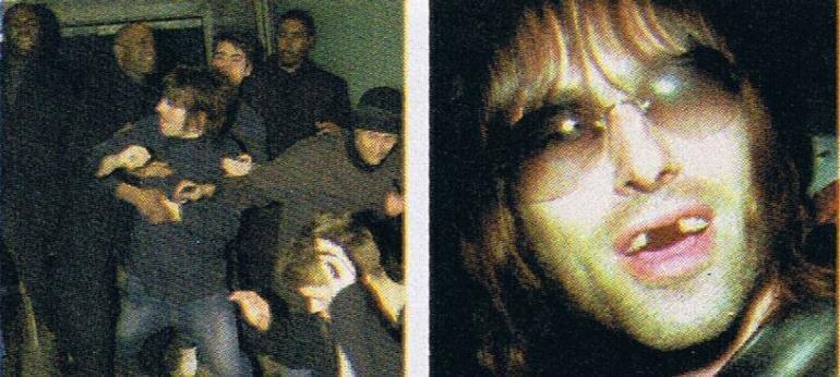 Liam Gallagher: Alman polisi dişlerimi söktü