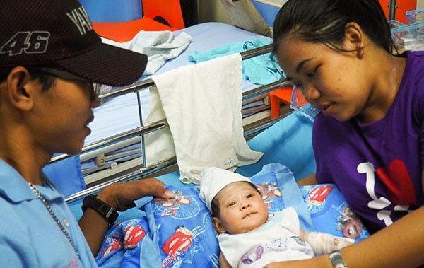 Filipinlerde boynuzlu bebek doğdu