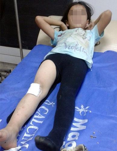PKK saldırısında yaralanan çocuk HDPli Buldanın yakını çıktı