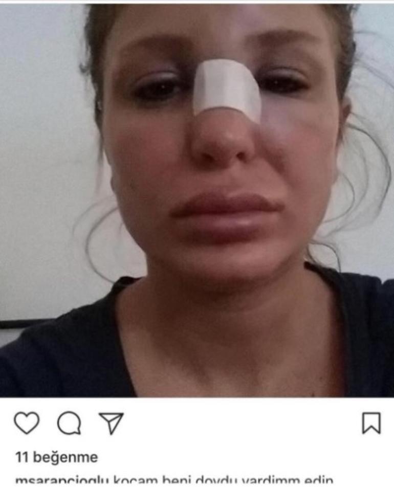 Berk Oktayın eşi Merve Şarapçıoğlu: Kocam beni dövdü, yardım edin