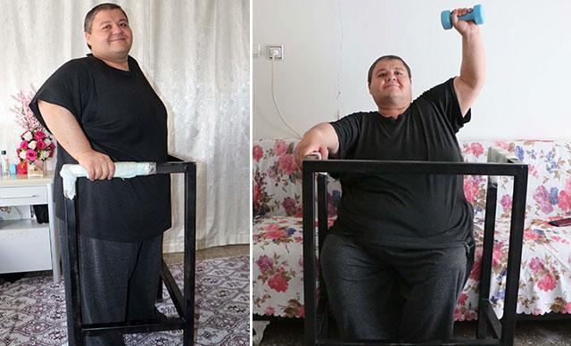 Tüp mide ameliyatıyla 280 kilodan 228 kiloya düştü Aydının tek bir hayali var
