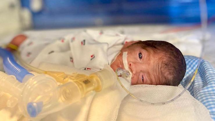Umut bebek hayata tutundu 23 haftalıkken dünyaya gelmişti