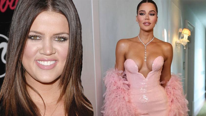 Khloe Kardashian yaptırdığı estetikleri tek tek anlattı! Saç çizgisinden, somon spermine her şey var!
